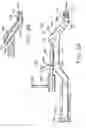 Fig. 40 - Method and apparatus for performing a minimally invasive total hip arthroplasty