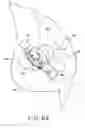 Fig. 46 - Method and apparatus for performing a minimally invasive total hip arthroplasty