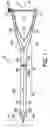 Fig. 02 - Spinal disc space distractor