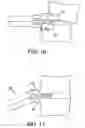 Fig. 08 - Spinal disc space distractor