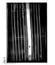 Fig. 04 - Apparatus and method for aligning and positioning implants in a body