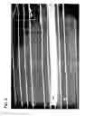 Fig. 06 - Apparatus and method for aligning and positioning implants in a body