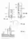Fig. 12 - Devices and methods for treating morbid obesity