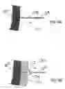 Fig. 17 - Devices and methods for treating morbid obesity