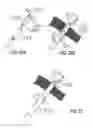 Fig. 22 - Devices and methods for treating morbid obesity