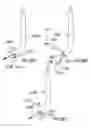 Fig. 23 - Devices and methods for treating morbid obesity