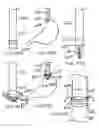 Fig. 38 - Devices and methods for treating morbid obesity