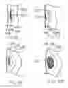 Fig. 40 - Devices and methods for treating morbid obesity
