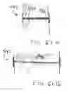 Fig. 45 - Devices and methods for treating morbid obesity