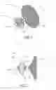Fig. 02 - System and method for delivering a left atrial appendage containment device
