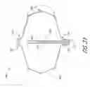 Fig. 28 - System and method for delivering a left atrial appendage containment device