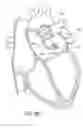 Fig. 37 - System and method for delivering a left atrial appendage containment device