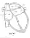 Fig. 40 - System and method for delivering a left atrial appendage containment device