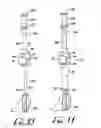 Fig. 08 - Medical device introducer and obturator and methods of use