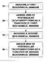 Fig. 01 - Methods for identifying patients at risk for life threatening arrhythmias