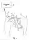 Fig. 02 - System and method for ventricular pacing with progressive conduction check interval