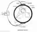 Fig. 01 - Method and device for treating osteoarthritis and cartilage disease, defects, and injuries in the human hip
