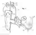 Fig. 02 - Stimulation mode for cochlear implant speech coding