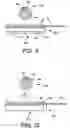 Fig. 09 - Method and apparatus for endovenous pacing lead