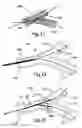 Fig. 09 - Ostial stent