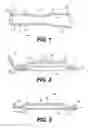 Fig. 02 - Stents, stenting systems, and related methods for agent delivery