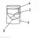 Fig. 01 - Method for producing an aortic or mitral heart valve prosthesis and resulting aortic or mitral heart valve