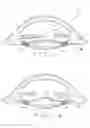 Fig. 02 - Ophthalmological zonular stretch segment for treating presbyopia