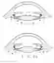 Fig. 04 - Ophthalmological zonular stretch segment for treating presbyopia