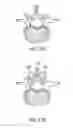 Fig. 18 - Spinal cage insert, filler piece and method of manufacturing