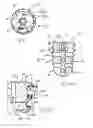 Fig. 03 - Subtalar implant assembly