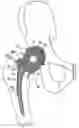 Fig. 01 - One piece snap fit acetabular cup