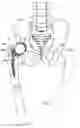 Fig. 03 - One piece snap fit acetabular cup