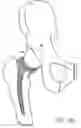 Fig. 09 - One piece snap fit acetabular cup