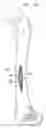 Fig. 41 - One piece snap fit acetabular cup