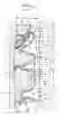 Fig. 02 - Method for treating an implant, and such an implant