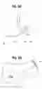 Fig. 09 - Prosthetic foot with tunable performance