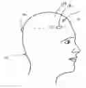 Fig. 01 - System and method for measuring the linear and rotational acceleration of a body part