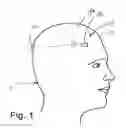 Fig. 02 - System and method for measuring the linear and rotational acceleration of a body part