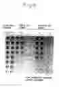 Fig. 06 - Process for producing physiologically active protein using genetically modified silkworm