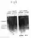 Fig. 07 - Process for producing physiologically active protein using genetically modified silkworm