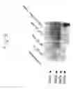 Fig. 20 - Process for producing physiologically active protein using genetically modified silkworm