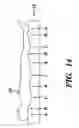Fig. 15 - Discrete cell body support and method for using the same to provide dynamic massage