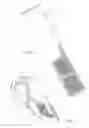 Fig. 03 - Hand grip device