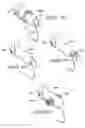 Fig. 10 - Navigable waterfowl retrieving apparatus, retrieving apparatus for waterborne objects, and method for retrieving waterfowl carcasses from a body of water