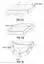 Fig. 02 - Methods and apparatus for fabricating, handling and transporting elongate bags of material