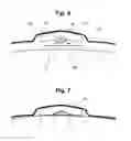 Fig. 07 - Method and outfit for measuring of action of muscles of body