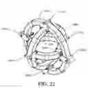 Fig. 20 - Apparatus and method for gyroscopic propulsion