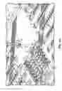 Fig. 09 - Packaging and organizing orthodontic appliances for loading of set-up trays therewith