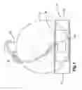 Fig. 02 - Aircraft wheel immobilizer