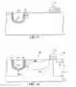 Fig. 05 - Angled implant for trench isolation